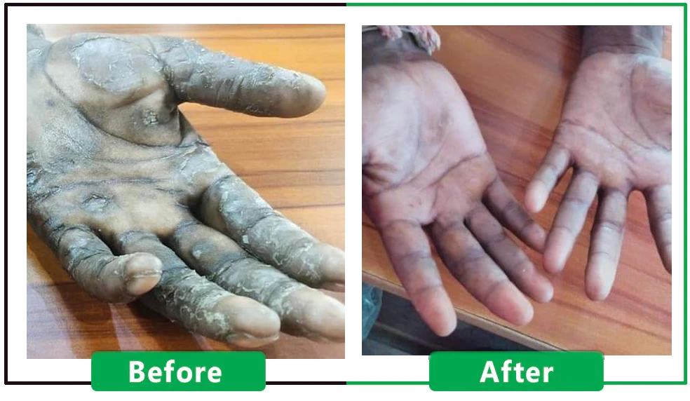 Patient Result