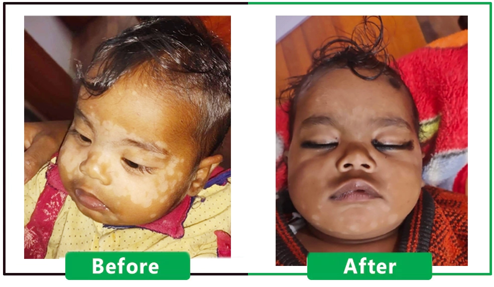 Patient Result