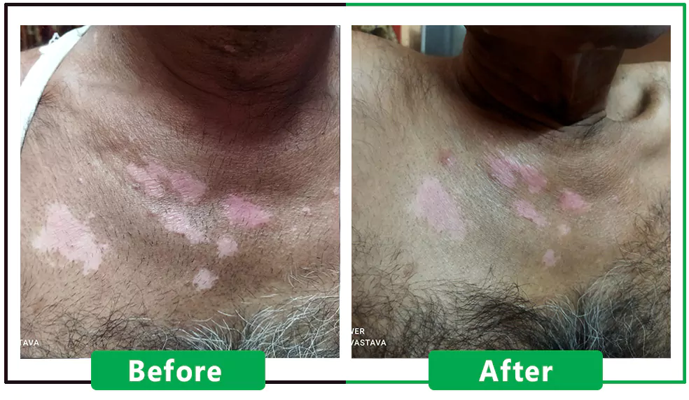 Patient Result