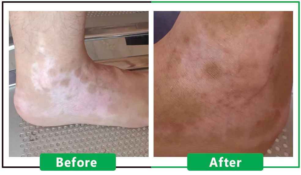 Patient Result