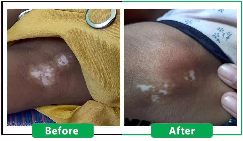 Patient Result