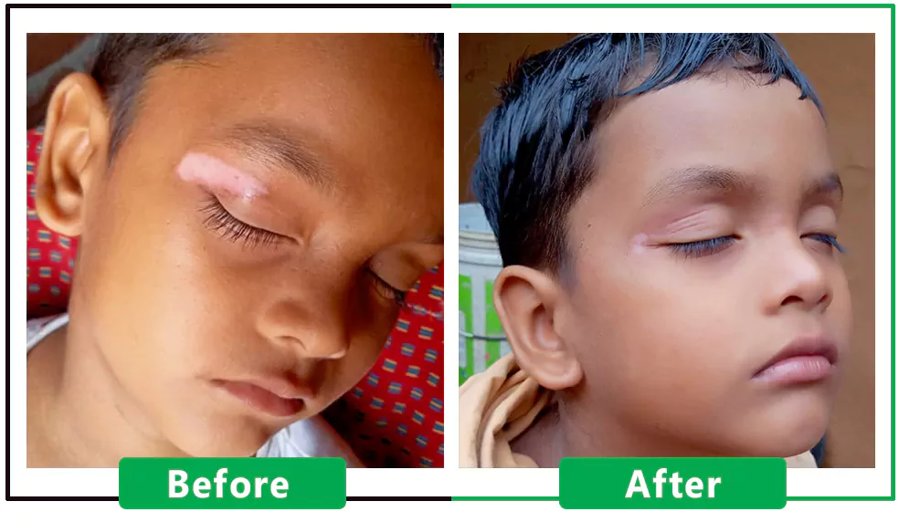 Patient Result